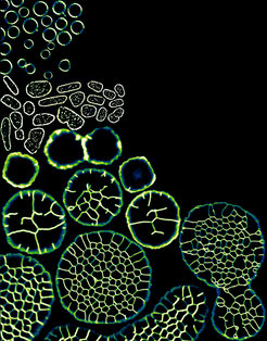 Sensing complex multicellularity: The observed transition of Haloferax volcanii, revealing archaea’s novel capacity to go from unicellular to complex multicellular structures when subjected to mechanical forces.